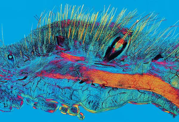 Поляризованная микрофотография участка кожи кошки, показывающая волосы, усы-вибриссы, служащие кошке органами осязания, и их кровоснабжение. Капилляры окрашены черным, волоски и вибриссы – желтым цветом. Снимок стал одним из победителей на конкурсе фотографии в области биологии и медицины Wellcome Image Awards, итоги которого были подведены 15 марта. 051_rusrep_03-1.jpg  Well Come Image Awards 2017
