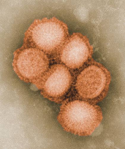 Свиной грипп (вирус A/H1N1) под электронным микроскопом 049_rusrep_05-1.jpg C. S. Goldsmith and A. Balish/ CDC Public Health Image library