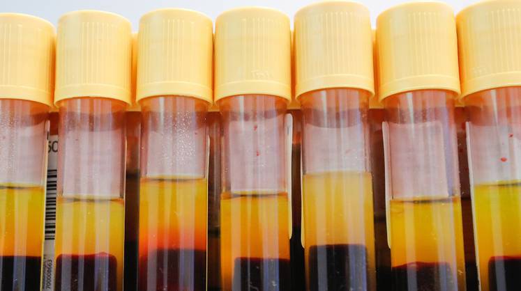 Опять допинг: WADA выявило подозрительные допинг-пробы у 298 российских спортсменов