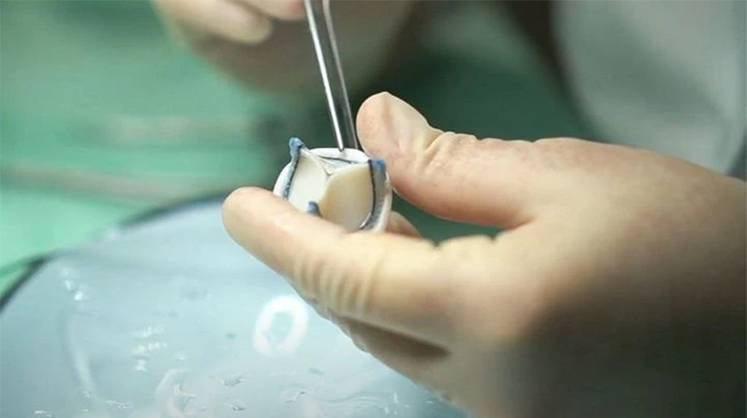 Сердечными искусственными клапанами мы обеспечены