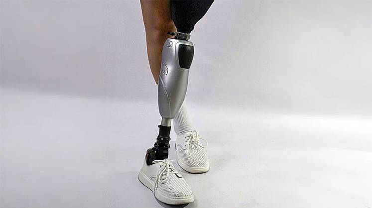 Протезирование: высокотехнологичный коленный модуль без микропроцессора