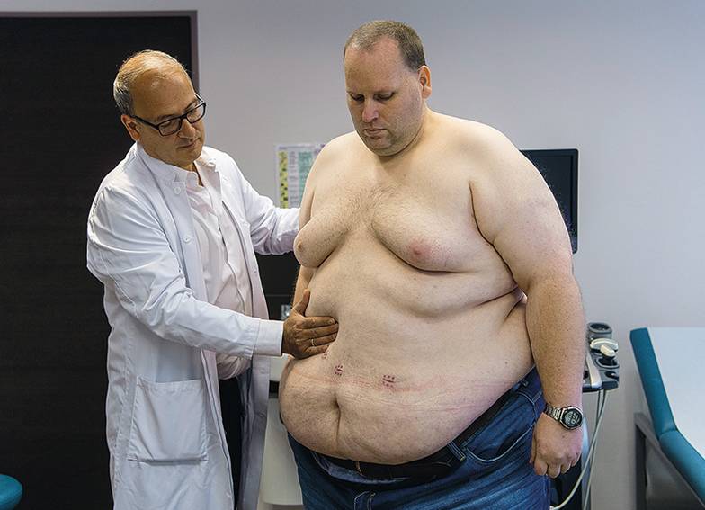 BORIS ROESSLER/DPA Ожирение приводит к развитию сердечно-сосудистых заболеваний, сахарному диабету 2-го типа, проблемам  с дыханием, артриту и разным типам онкологии. Вот бы вылечить все сразу одной таблеткой!