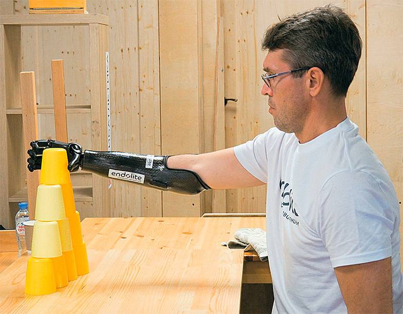 ОЛЕГ СЕРДЕЧНИКОВ Производители комплектующих в маркетинговых целях снимают ролики «У нас человек с протезом научился рисовать», забывая уточнить, что умение рисовать не входит в комплектацию протеза