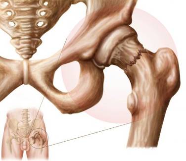 chastnyj-dom-prestarelyh.ru 