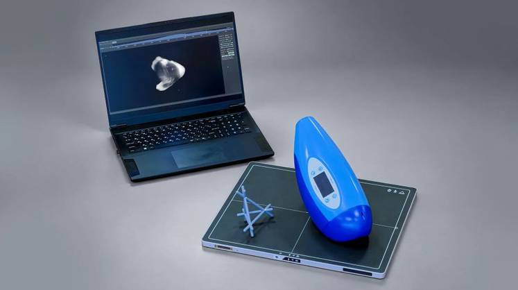 Российская Smart Engines разработала портативный 3D-томограф весом 5 кг